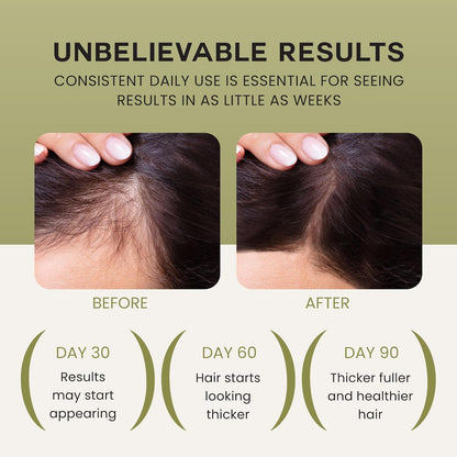 Lebanta Raw Batana Hair Growth Serum - Folireva